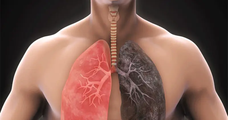 Lungs Diseases