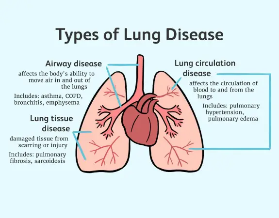 Lung Disease Treatment