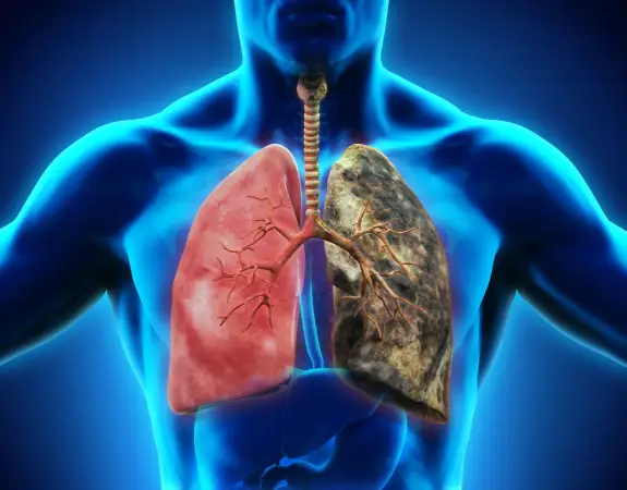 Lung Disease Diagnosis