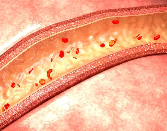 Advanced Vascular Diagnosis